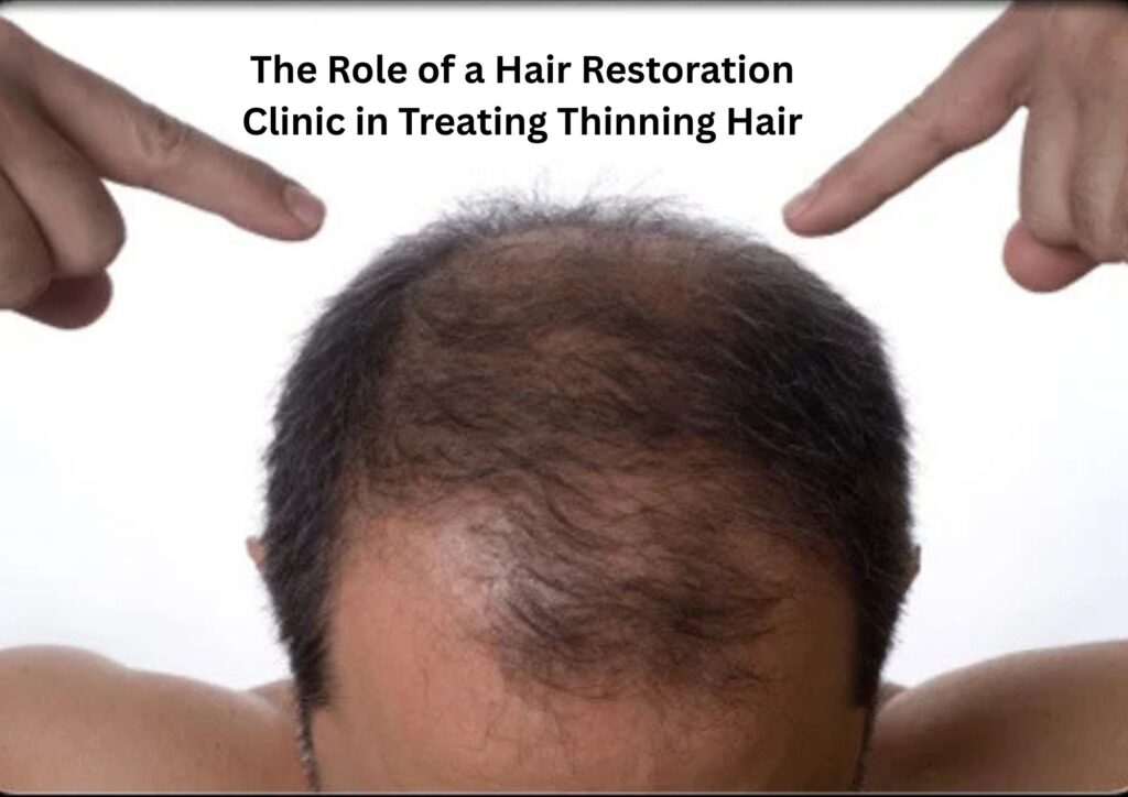 The Role of a Hair Restoration Clinic in Treating Thinning Hair