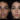 Septoplasty in Dubai