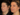 sculptra fillers in dubai