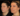sculptra fillers in dubai