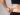 Liposuction in Dubai