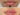 Juvederm