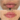 Juvederm