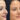 Rhinoplasty in Dubai