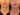 sculptra fillers in dubai
