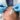 hair restoration cost