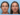 Non-Surgical Facelifts at the Best Aesthetic Clinics in Dubai for Thread Lift