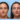 Non-Surgical Facelifts at the Best Aesthetic Clinics in Dubai for Thread Lift