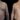 gynecomastia in dubai