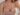male breast reduction, mia femtech in jeddah, breast reduction, breast lift with implants,