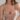 male breast reduction, mia femtech in jeddah, breast reduction, breast lift with implants,