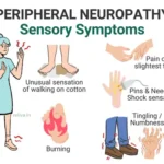 Peripheral Neuropathy Sensory Symptoms