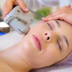 HIFU facial treatment